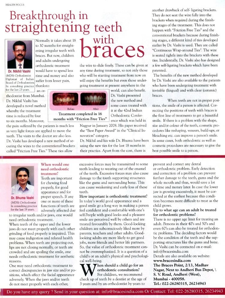 Breakthrough in straightening teeth with braces. (Women's Era, 2009)