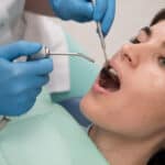 Find Out The Common Signs Of Infection After A Tooth Extraction