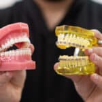 What Is The Invisalign Braces Cost In Mumbai